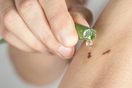 Aloe Vera for skin