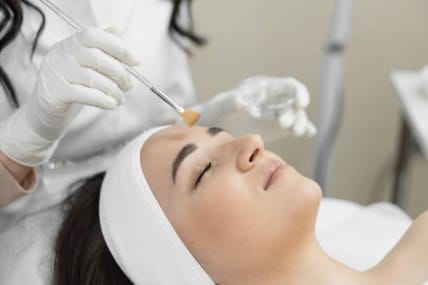 tca Peels